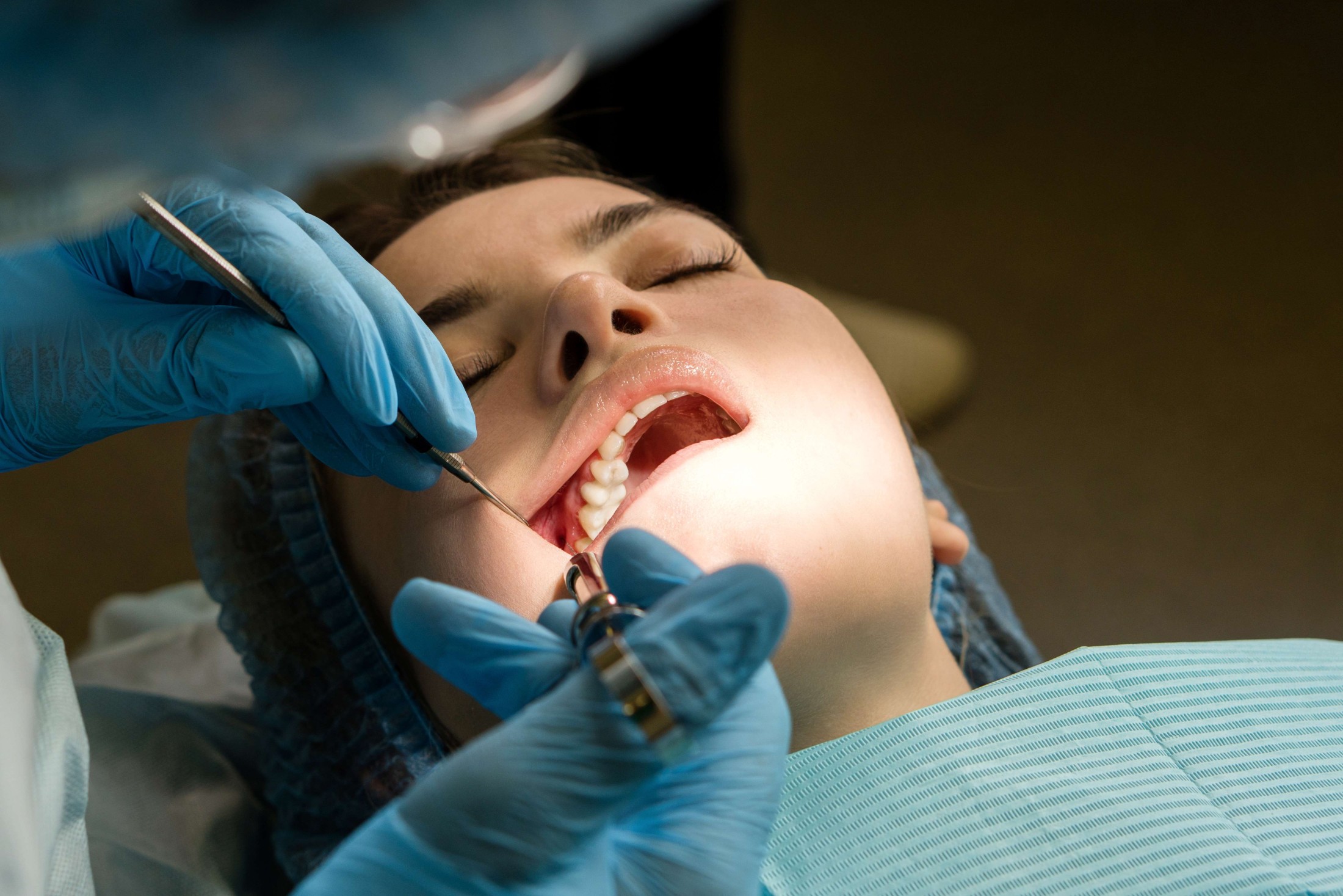 Wisdom teeth removal